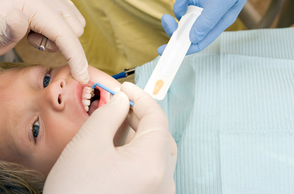 Young boy receiving fluoride treatment at dentist at Myers Park Dental Partners in Charlotte, NC 28207-1860